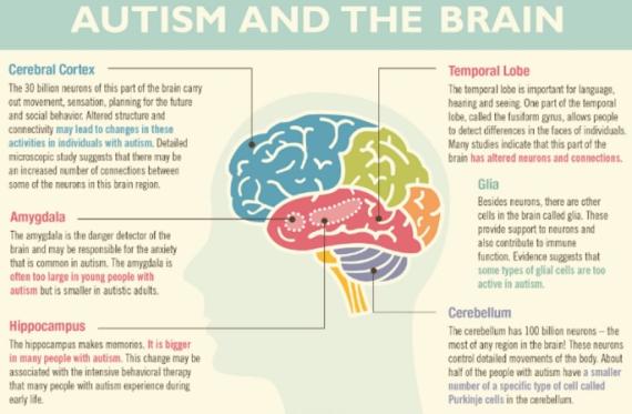 Autism and the brain infographic