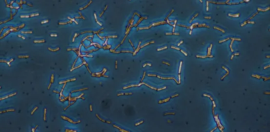 Micrograph of Lactobacillus bacteria