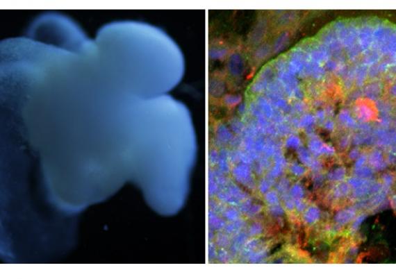 Image of a human brain organoid engineered in Dr. Anand’s lab. It contains cortex, midbrain, brain stem and spinal cord tissues. Different cell types can be seen in the image at right