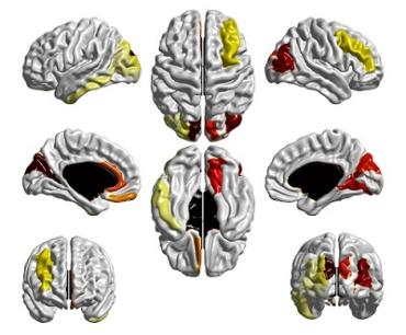 Expanded brain surface illustration